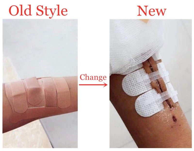 Mediss لاصقات لاصقة لإغلاق الجروح الطارئة، ملصقات خياطة سريعة للتخييم، البقاء ومعدات المنزل، 3 قطع (45 * 10 مم، جلد) - Image 3