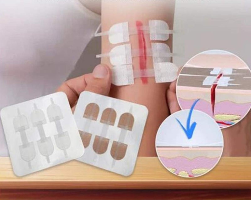 Mediss لاصقات لاصقة لإغلاق الجروح الطارئة، ملصقات خياطة سريعة للتخييم، البقاء ومعدات المنزل، 3 قطع (45 * 10 مم، جلد) - Image 5