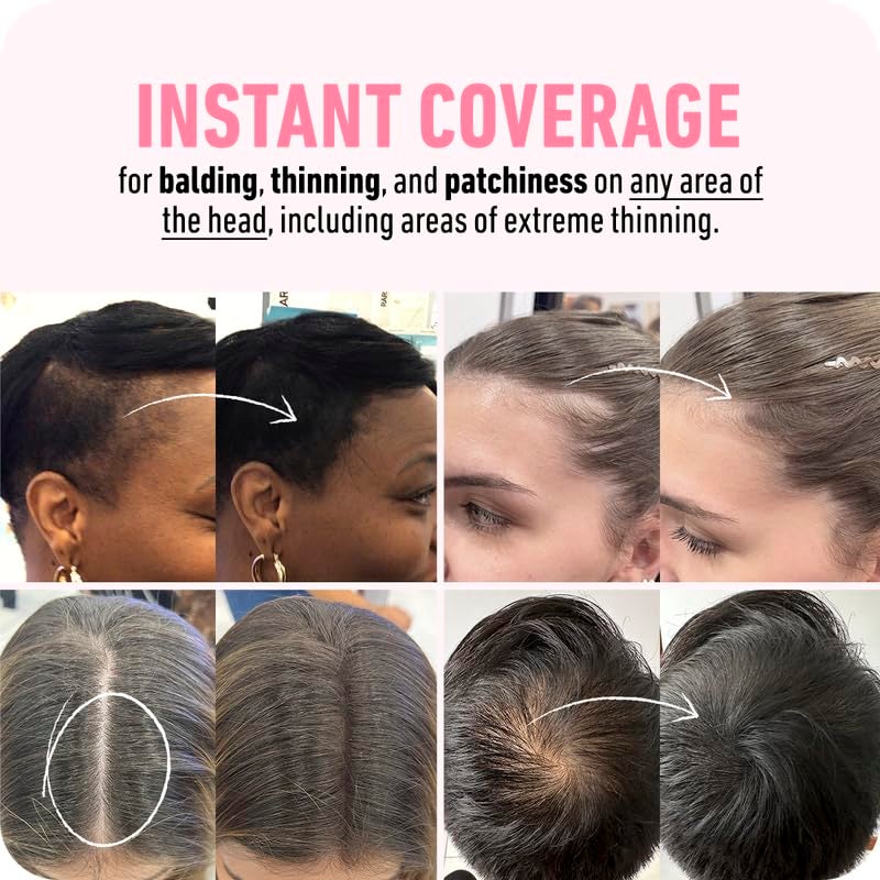 Boldify Hairline Powder + Shampoo: Bundle: Root Touchup Hair Loss Powder and Natural Volumizing Shampoo for Fine Hair (Auburn) - Image 2