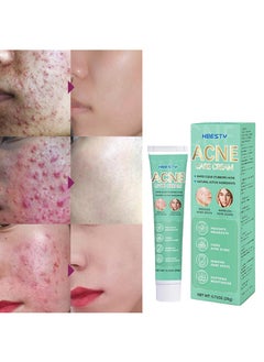 HBESTY Acne Care Cream，Acne Treatment Face Cream，Oil Control Anti Acne Facial Care ，Acne Spot ，Cystic Acne，Fungal Acne ，Face Acne Spot Treatment and Acne Scar Treatment Post Acne Marks Treatment，Pimple Remover， Acne Repair 20g  - Image 4