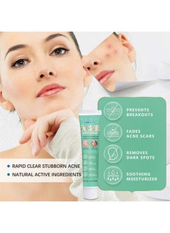 HBESTY Acne Care Cream，Acne Treatment Face Cream，Oil Control Anti Acne Facial Care ，Acne Spot ，Cystic Acne，Fungal Acne ，Face Acne Spot Treatment and Acne Scar Treatment Post Acne Marks Treatment，Pimple Remover， Acne Repair 20g  - Image 5