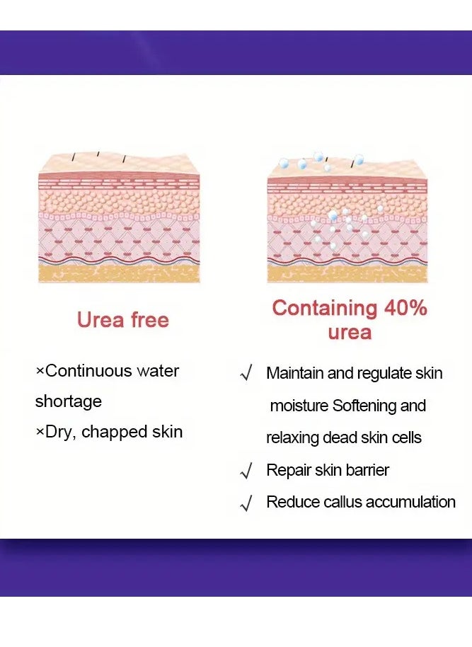 DERMFREE - 100ml 40% Urea Cream with 2% Salicylic Acid Intensive Moisturizing Hydrating Urea Cream for Rough Thick Dry Cracked Feet Hand Skin Remove Corn and Callus Exfoliates Soften Thick Dead Skin - Image 1
