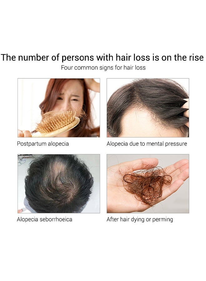 لان بينا زيت أساسي لنمو الشعر، العناية بالشعر ومنع تساقطه، نبات الزنجبيل الطبيعي يعزز كثافة الشعر 20 مل - Image 3