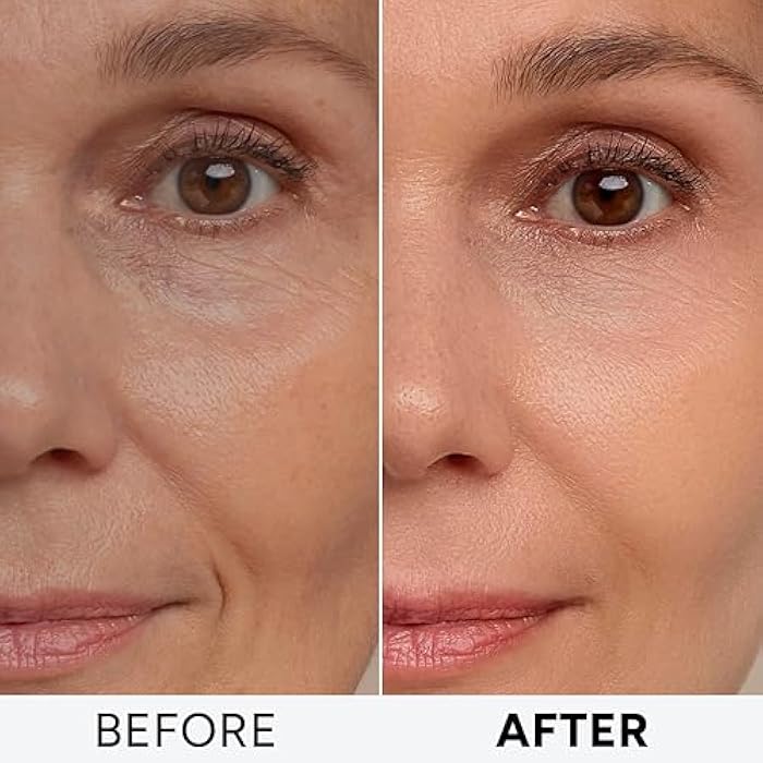 Arvesa Retinol Cream for Face with Collagen Peptides - Anti Aging Wrinkle Cream for Women and Men - Day-Night Facial Moisturizer with Hyaluronic Acid - Tightening and Skin Firming - Neck & Décolleté - Image 3
