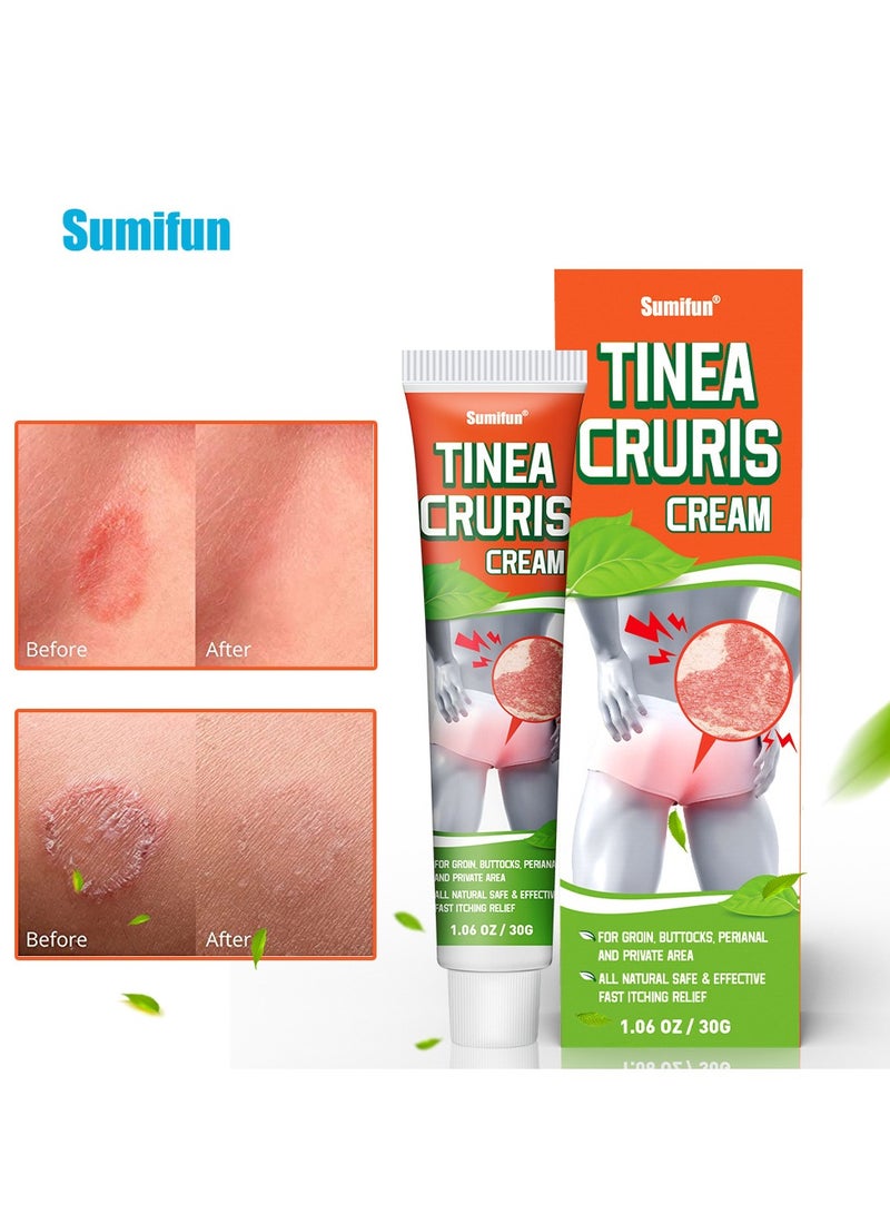 Sumifun Tinea Cruris Cream,For Groin Private Area. All Natural Safe Effective Fast Itching Relief ,Fungal Infections, Anti-itch, Relief for Sensitive, Irritated Skin 30g - Image 5