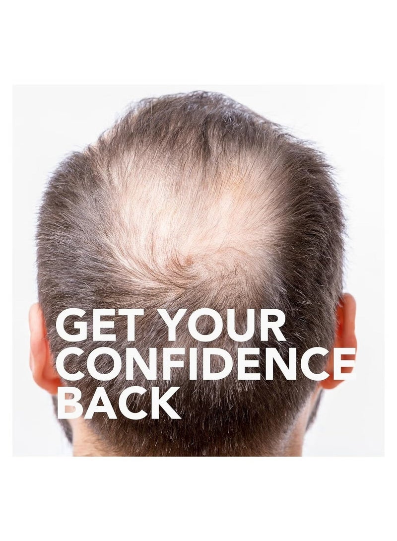 Kirkland Signature 6-Piece Minoxidil Hair Regrowth Treatment - Image 4
