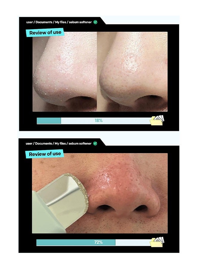 ilso Melting Sebum Softener - Sebum Remove Complex Centella Asiatica Extract, Carica Papaya Fruit Extract, Blackhead Remove, Melting Sebum Softener, Pores Cleanses - Image 3