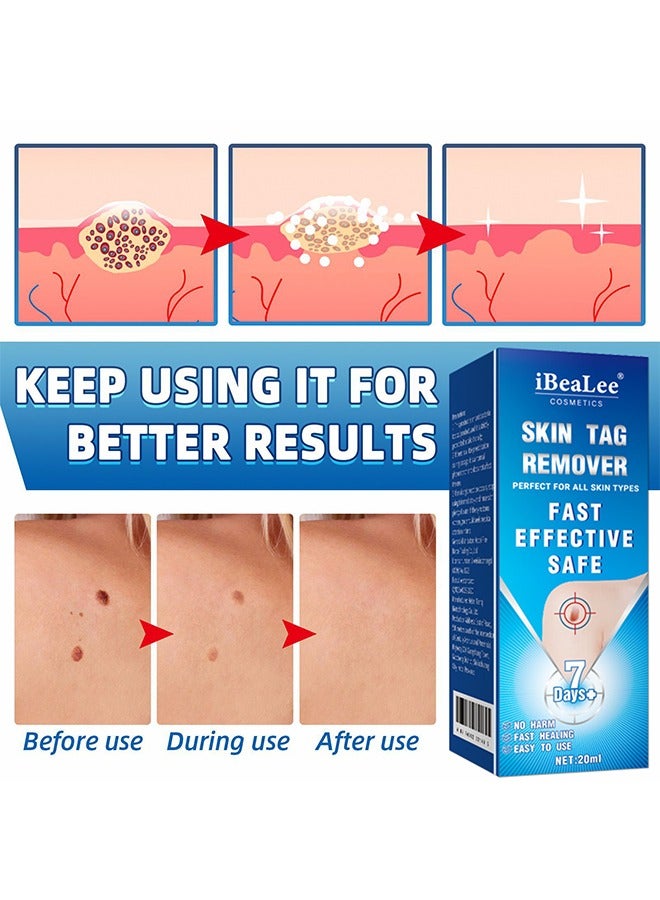 iBealee Painless Skin Tag Remover for Common Hand and Plantar Warts，Liquid Wart Removal Solution，Wart Removal Essential Oil A Gentle Safe With Natural Extracts For All Skin Types Universal For Both Men And Women  - Image 4