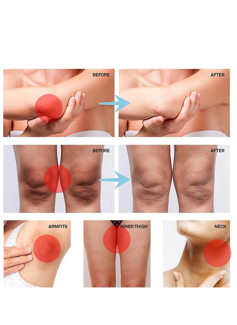 Generic - Thigh Rescue Anti-Friction Stick, Waterproof Anti-Chafe Balm for Skin Protection, Ideal for Running and Sports, Prevents Chafing and Scratches (40g) - Image 1
