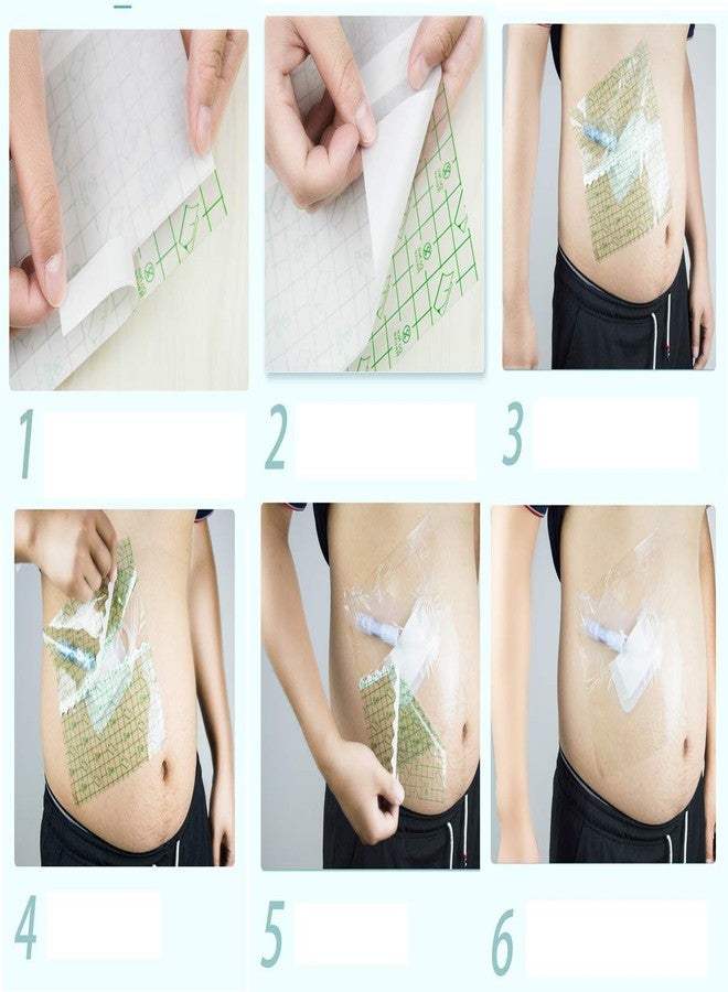 lifevv Shower Shield 8" x 8" PICC Line Cover Moisture Barrier，Wound Dressing -One Week Supply (7 Pack) - Image 3