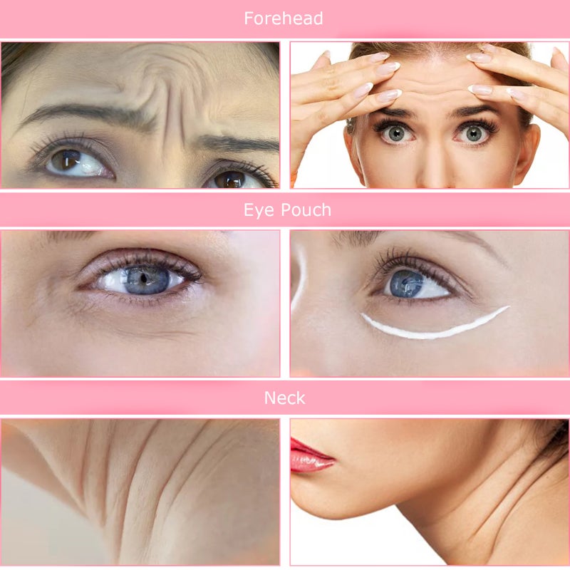 Face Wrinkle Remover Strips Reusable 11pcs Anti-Wrinkle Face Pads Silicone Face Patches Smoothing Wrinkle Patches for Forehead Eye Mouth Upper Lip & Chest Wrinkles Treatment Set - Image 2