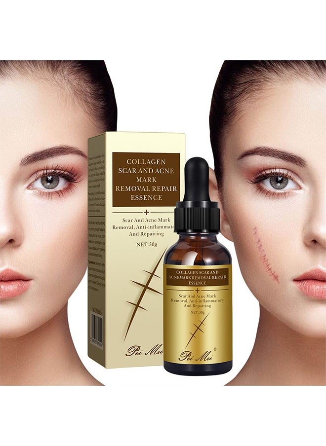 Pei Mei Collagen Scar and Acne Mark Removal Repair Essence - Moisturizing Soothing Facial Scar Removal Serum Collagen Skincare Serum Stretch Marks Serum Skin Repair Nourishing Serum Fat Streaks Removal Serum  - Image 1