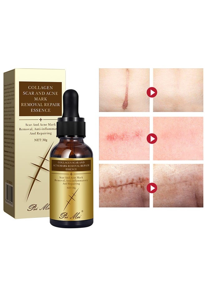 Pei Mei Collagen Scar and Acne Mark Removal Repair Essence - Moisturizing Soothing Facial Scar Removal Serum Collagen Skincare Serum Stretch Marks Serum Skin Repair Nourishing Serum Fat Streaks Removal Serum  - Image 3