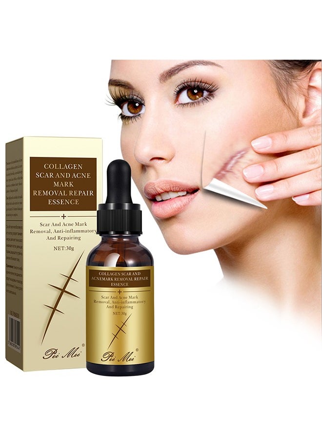 Pei Mei Collagen Scar and Acne Mark Removal Repair Essence - Moisturizing Soothing Facial Scar Removal Serum Collagen Skincare Serum Stretch Marks Serum Skin Repair Nourishing Serum Fat Streaks Removal Serum  - Image 2