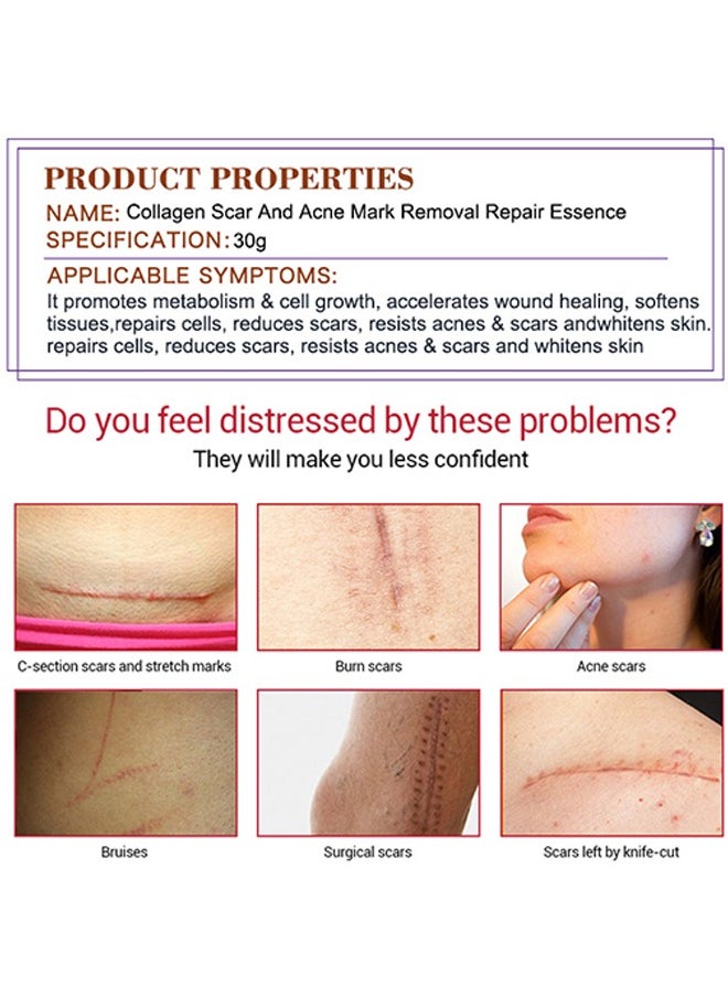 Pei Mei Collagen Scar and Acne Mark Removal Repair Essence - Moisturizing Soothing Facial Scar Removal Serum Collagen Skincare Serum Stretch Marks Serum Skin Repair Nourishing Serum Fat Streaks Removal Serum  - Image 5