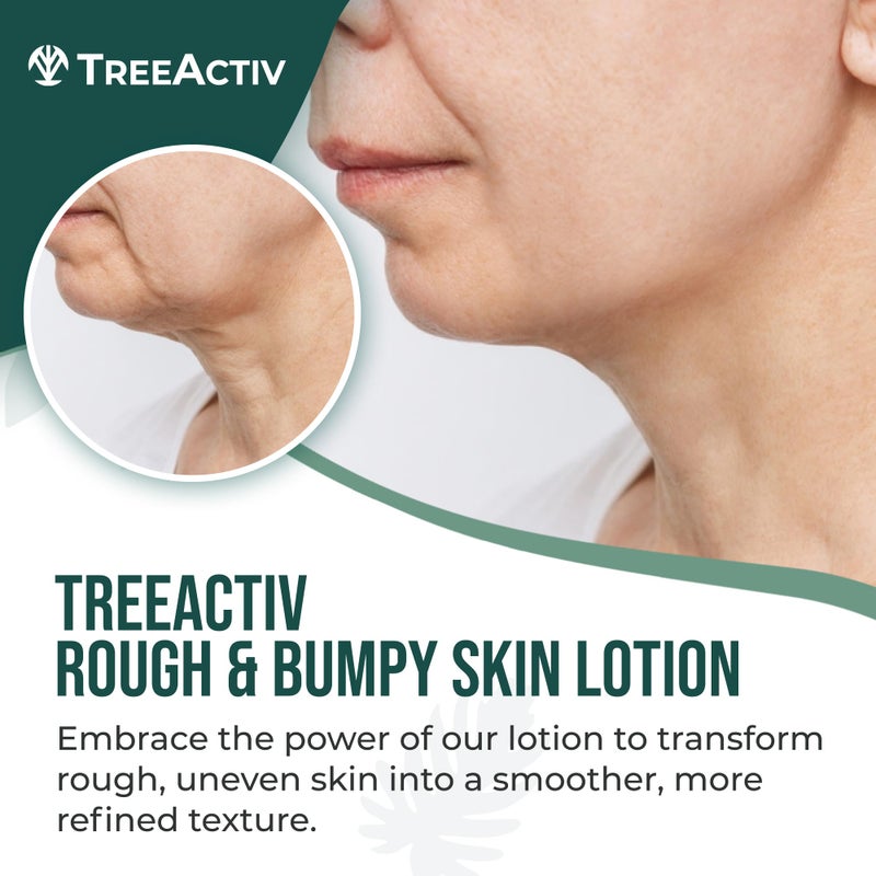 TreeActiv Rough and Bumpy Skin Lotion, 8 fl oz, With Hyaluronic Acid, Shea Butter and Vitamin E, Nourishing Lotion for Rough and Bumpy Skin, Moisturizing Strawberry Legs, For All Skin Types - Image 2