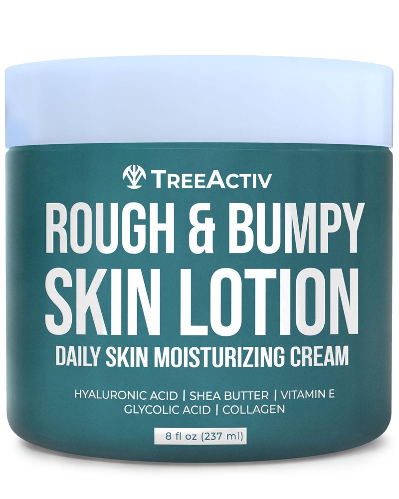 TreeActiv Rough and Bumpy Skin Lotion, 8 fl oz, With Hyaluronic Acid, Shea Butter and Vitamin E, Nourishing Lotion for Rough and Bumpy Skin, Moisturizing Strawberry Legs, For All Skin Types - Image 1