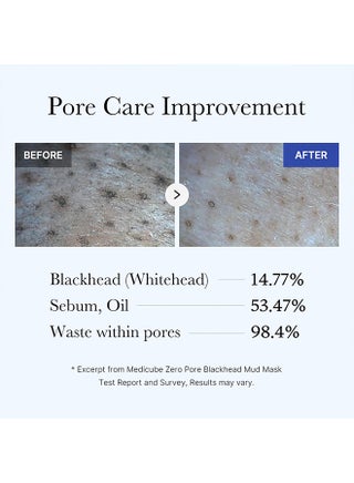 Zero Pore Blackhead Mud Facial Mask - Skin Cooling And Pore Tightening - 3 Minute Quick Dry Formula With Aha, Bha, Pha, And Pore-Purifying Clay - Korean Face Mask 3.52 Oz - view 5