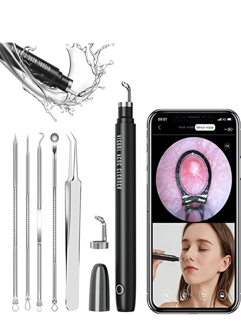 إزالة الرؤوس السوداء، يمكن توصيلها بالهاتف لاستخدام مكبر، لأداة تنظيف عميق وتقشير للبشرة، مزودة بأدوات علاج حب الشباب - Image 1