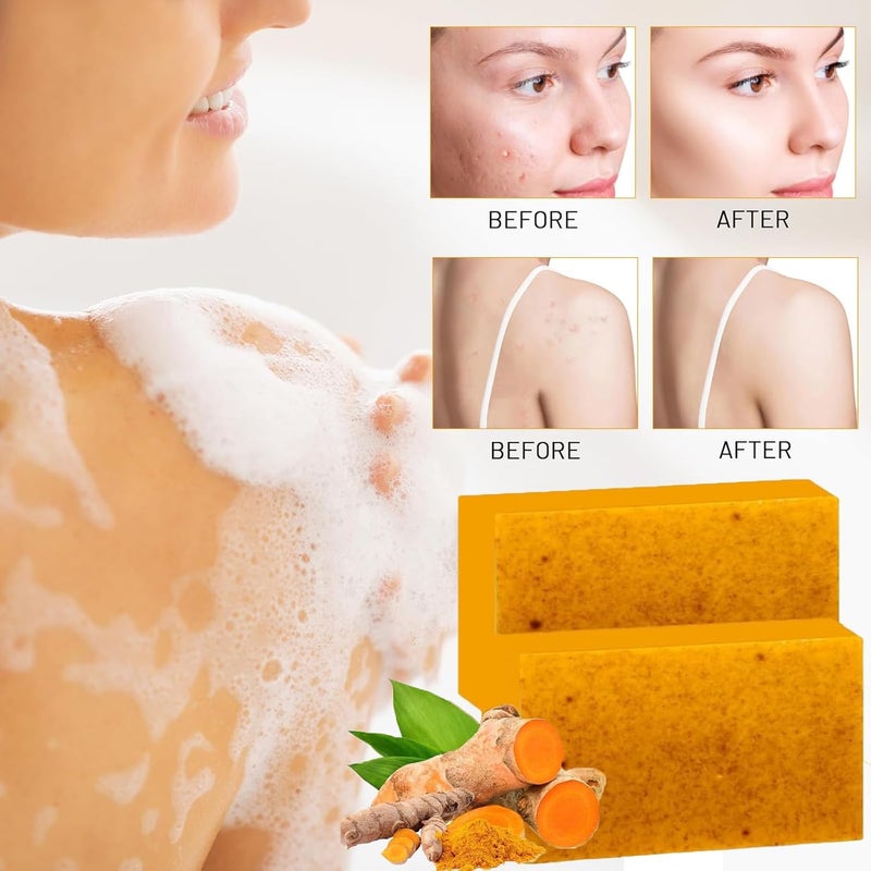 LuckNest 4Pcs Turmeric Wash and Care Set Tuemeric Facial Cleanser Turmeric Cleansing Exfoliating Pads Soap Combo Cleansing Mousse Face Wash and Soap Bundle for Face Body - Image 4