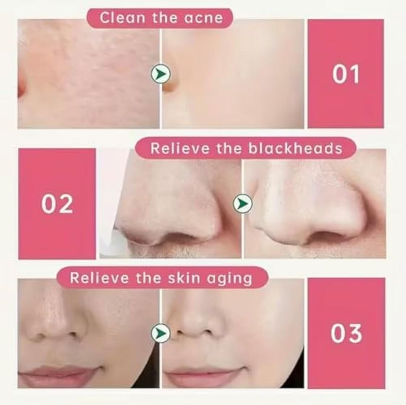 5PCS Natural Silk Cocoon Facial Scrubber for Face Cleansing & Exfoliation – Gentle Deep Pore Cleaner, Blackhead Remover, Finger Cocoon Facial Massage Tool for Smooth Skin - Image 4