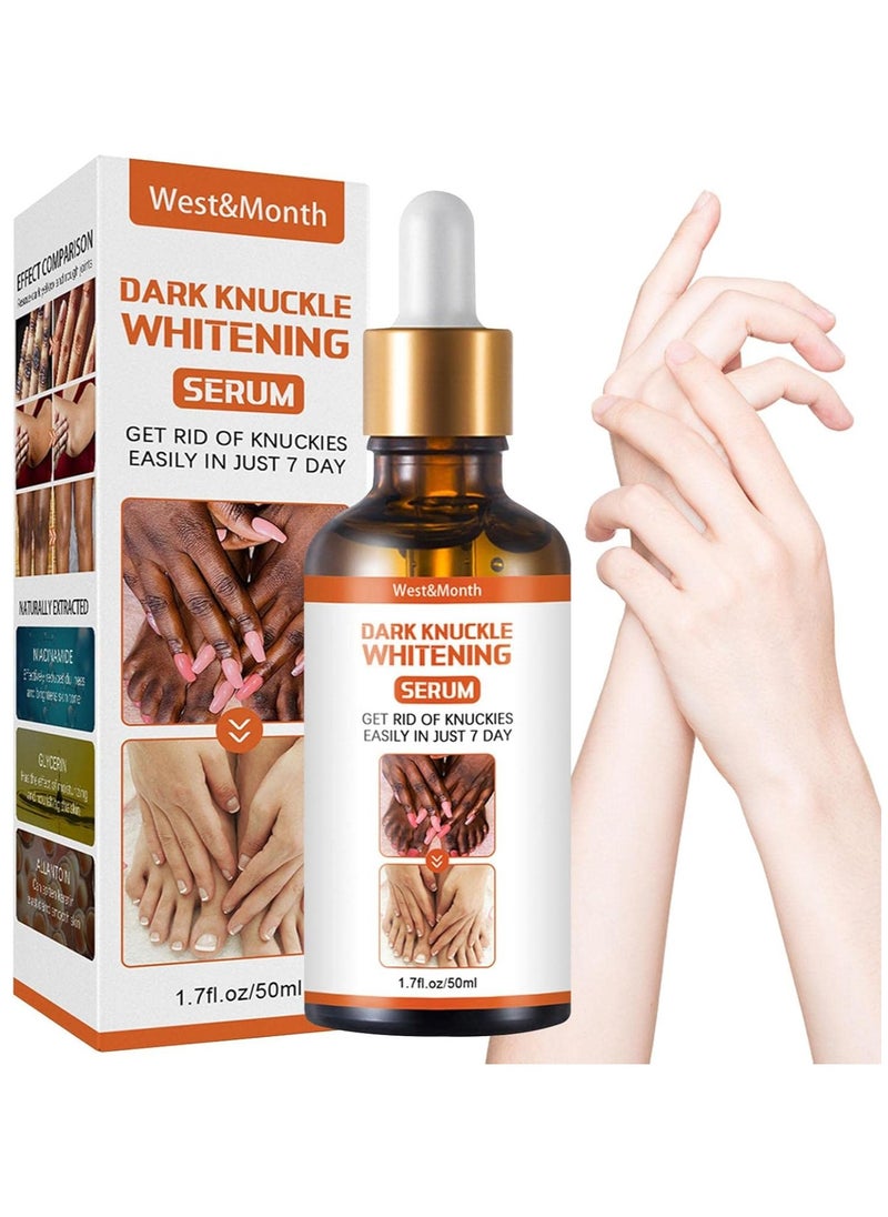 West&Month Dark Knees Quick Whitening Cream Pigmentation Correctors For Black Skin Remover Elbow Intense Hand Serum Spot Knob Knee  - Image 1