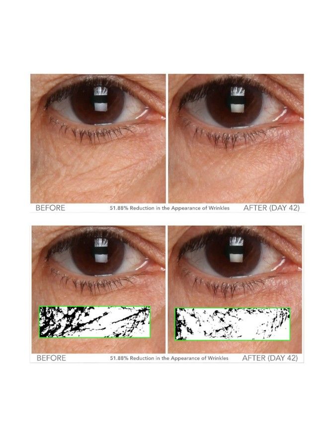 Serious Skincare C3 Plasma C Eye Vitamin C Ester Eye Beauty Treatment 0.5 Oz. For Bright & Hydrated Under Eyes Soothing Gel Formula Fine Lines Wrinkles & Crow’S Feet Mature Dry Skin - Image 4