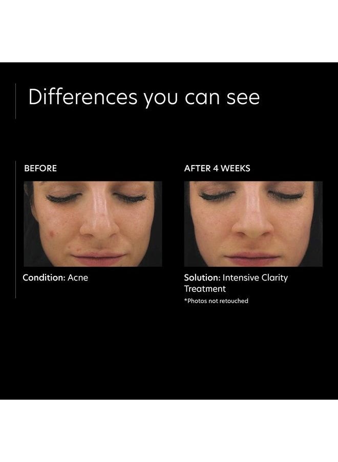 PCA SKIN Intensive Clarity Treatment - 0.5% Pure Vitamin A Retinol & 2% Salicylic Acid Face Serum for Acne-Prone Skin (1 oz)  - Image 4
