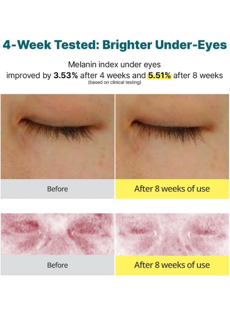 GOODAL Dark Circles & Tired Eyes Solution – Goodal Green Tangerine Vitamin C Brightening Eye Cream - Image 4