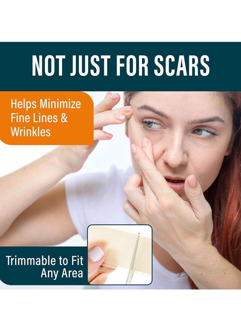 Nuvadermis NUVADERMIS Silicone Scar Sheets - Extra Long Scar Sheets Silicone Scar Sheets - Pack of 4  - Image 2