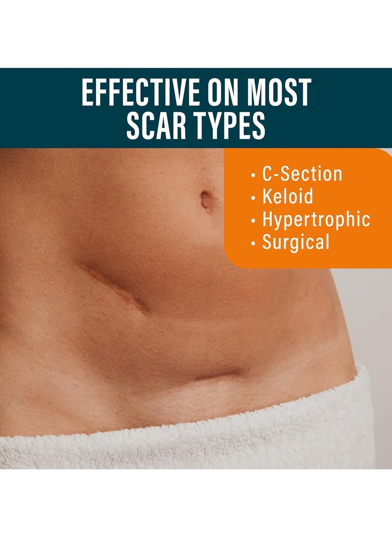 Nuvadermis NUVADERMIS Silicone Scar Sheets - Extra Long Scar Sheets Silicone Scar Sheets - Pack of 4  - Image 3