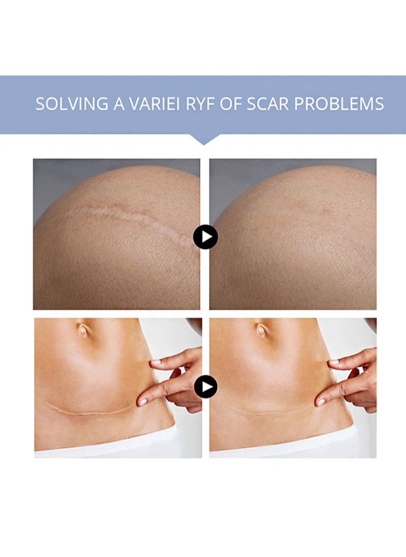 MSLAM - Scar removal cream, scar removal cream suitable for new and old scars on cuts, stretch marks, face and body burn recovery cream (20g) - Image 1