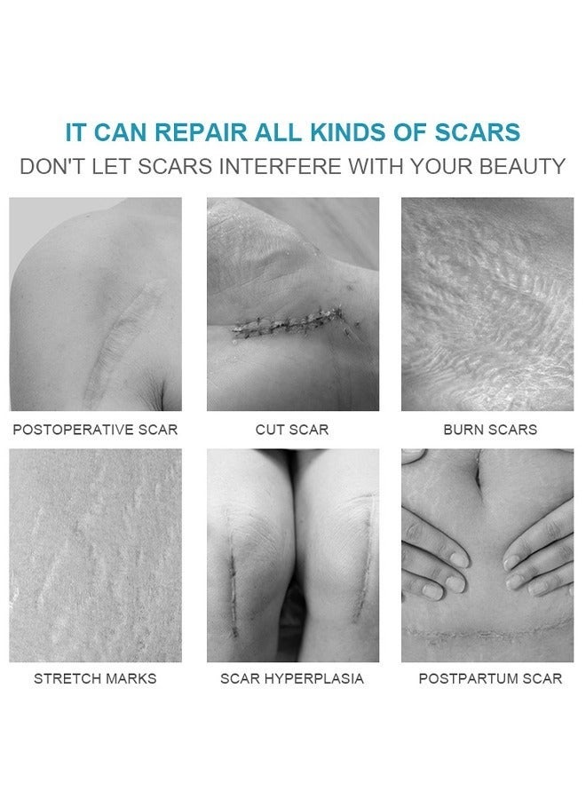 LANEMAY Scar Disappears, Medical Grade Silicone Scar Cream Advanced Scar Removal Gel For Surgical Scars Stretch Marks Acne Injury Burns Keloids Hypertrophic Old And New Scars 20G - Image 3
