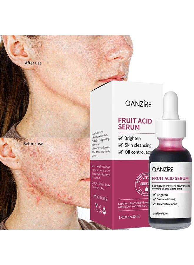 QANZIRE Fruit Acid serum - to Revitalize Your Skin Facial Serum for Smooth and Glowing Skin Premium Facial Serum for Hydration and Brightening Anti-aging Serum for All Skin Types - Image 1