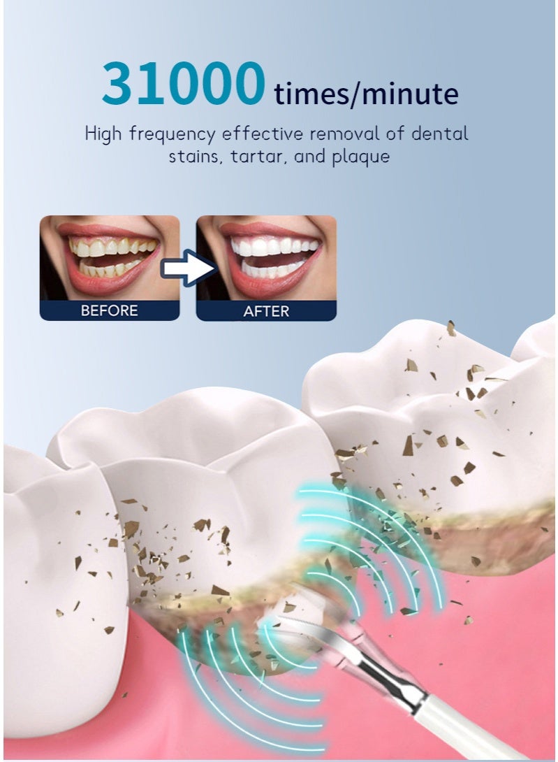 Electric Toothbrush Ultrasonic Tooth Cleaner Teeth Stains Plaque Remover with 6 toothbrush head (white) - Image 4