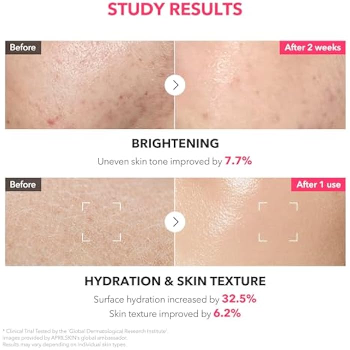APRILSKIN TXA+Niacinamide 99 Pink Milky Toner | 99% High-Purity TXA 3%+ Niacinamide 5% for Brightening | Highly Concentrated Cream Toner | Deep Moisturizing Formula for Dull Skin | 5.07 fl.oz. - Image 5