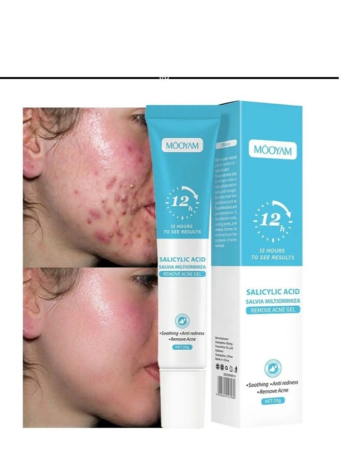 MOOYAM Acne Treatment Gel,Anti Acne Removal Cream,Spot Cream for Acne,Spot Treatment for Face,Face Care Acne Cream,Acne Gel,Acne Scar Treatment,Daily Skin Care,Acne Moisturiser,Acne Scars Recovery 1Pcs  - Image 1