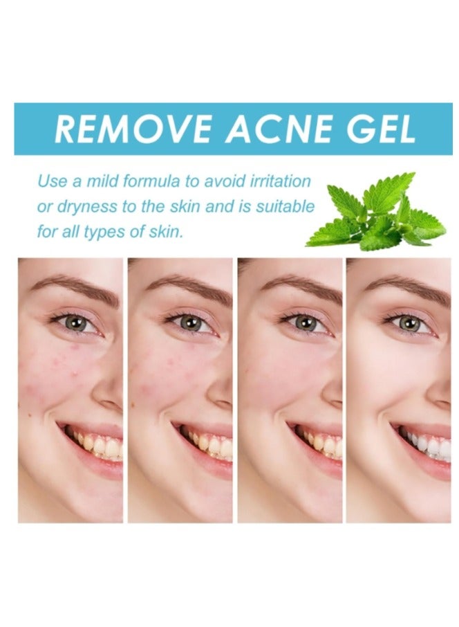 MOOYAM Acne Treatment Gel,Anti Acne Removal Cream,Spot Cream for Acne,Spot Treatment for Face,Face Care Acne Cream,Acne Gel,Acne Scar Treatment,Daily Skin Care,Acne Moisturiser,Acne Scars Recovery 1Pcs  - Image 4