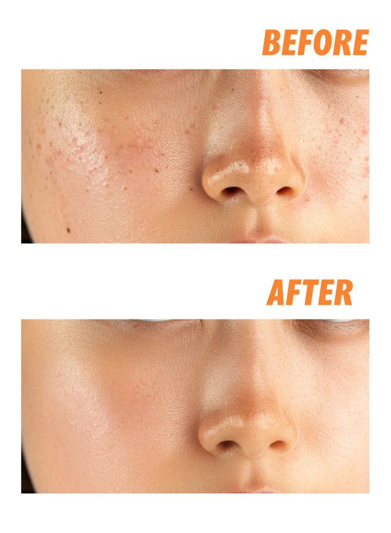 nightingale Korean C Toning Sleeping Mask with Vitamin C, Niacinamide, Hyaluronic Acid