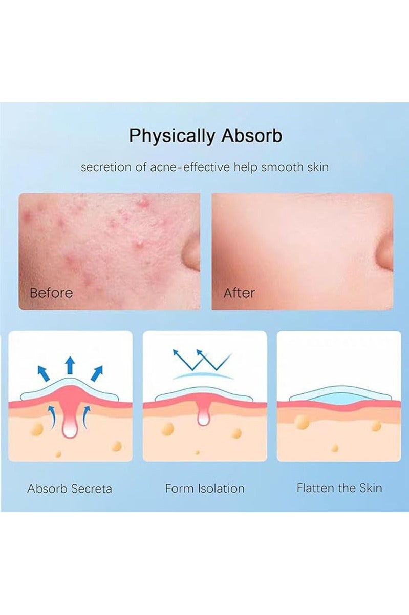 Sthxyfaith Acne Pimple Patches,Hydrocolloid Acne Patch for Covering Face, Blemishes, Zits Absorbing Patch,Cosmetics Patch for Pimple Dots, Acne Treatment, Invisible Acne Spot Patches(150 Count) - Image 2