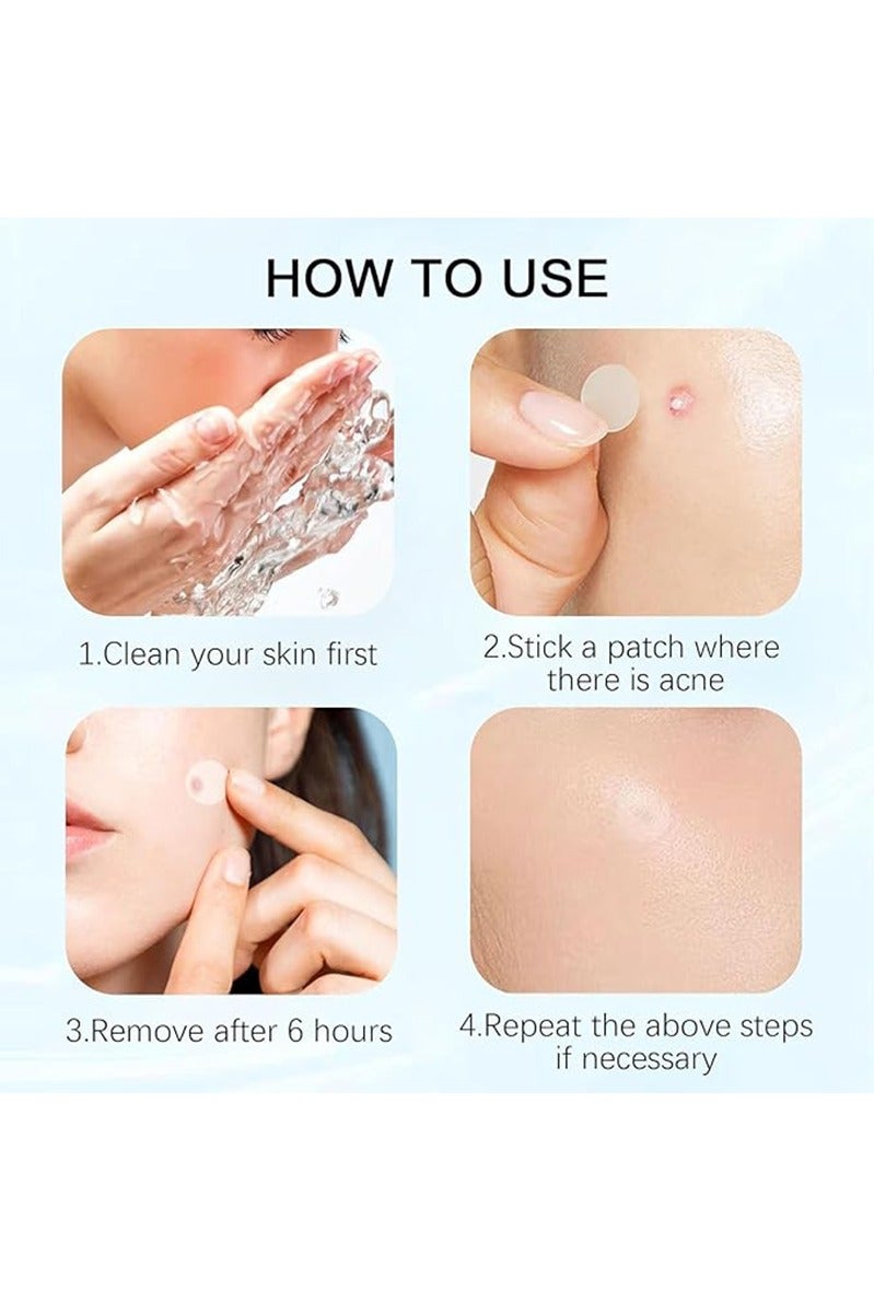 Sthxyfaith Acne Pimple Patches,Hydrocolloid Acne Patch for Covering Face, Blemishes, Zits Absorbing Patch,Cosmetics Patch for Pimple Dots, Acne Treatment, Invisible Acne Spot Patches(150 Count) - Image 3