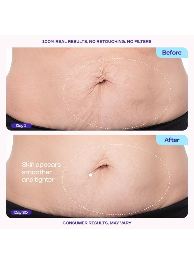 جو بيور كريم البطن الشديد والسلس - اختبر سريريًا مع مجمع MicroTight4 لتقليل مظهر علامات السيلوليت والتمدد - امتصاص سريع لبشرة أكثر سلاسة وأكثر قوة ، 4.25 أوقية - Image 3