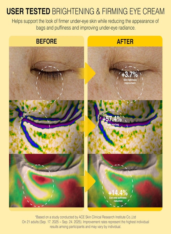Be-Hope Eye Lifting Roller Cream | Camellia + Adenosine | Firming Eye Care - Image 2