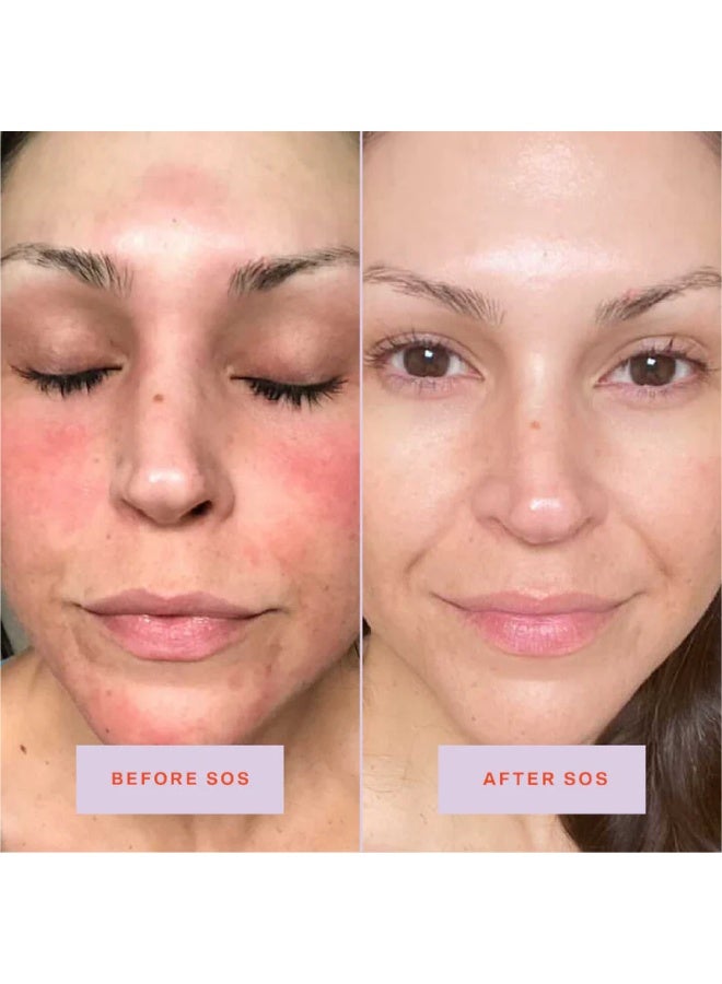 تاور 28 بخاخ الوجه اليومي للإنقاذ من إس أو إس | تونر مُهدئ ومنعش ومُوازن لدرجة الحموضة | حمض هيبوكلوروس مُصمم للبشرة الحساسة | 113 مل - Image 4