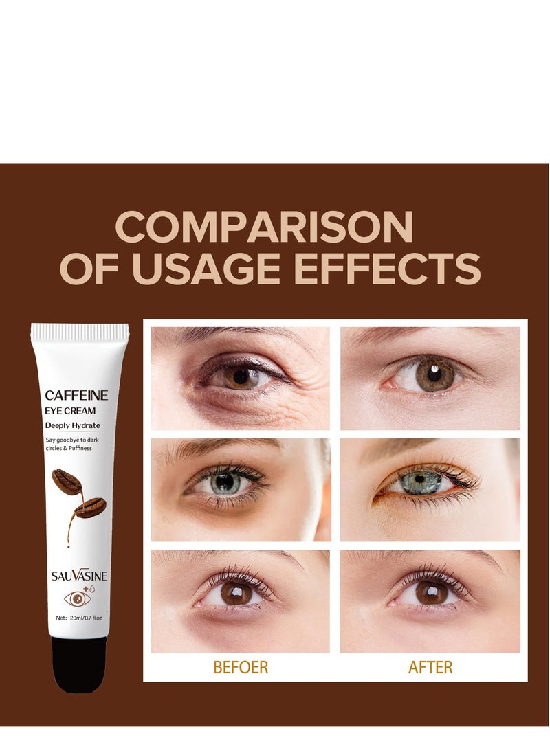 caffeine eye cream for puffy eye 20ml - pzsku/Z101EA118F3F2FBAABD2EZ/45/_/1722242773/0fdeeb80-0118-4234-90bd-957f2e6f950d