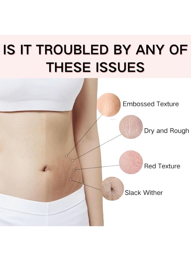 SYOSI Scar Removal and Stretch Mark Cream, Pregnancy & Anti-Aging Moisturizer for Effective Scar Repair – Silicone Scar Gel (150g) for New and Old Scars, Including C-Section, Stretch Marks - Image 4