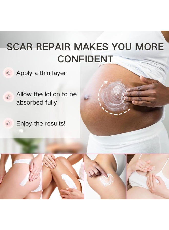 SYOSI Scar Removal and Stretch Mark Cream, Pregnancy & Anti-Aging Moisturizer for Effective Scar Repair – Silicone Scar Gel (150g) for New and Old Scars, Including C-Section, Stretch Marks - Image 3