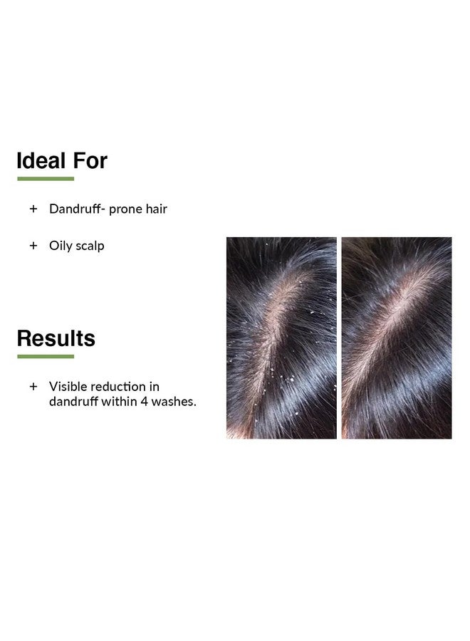 FIXDERMA Kairfoll Anti Dandruff Shampoo For Oily Sensitive Scalp Prone To Dandruff & Folliculitis | Anti Dandruff Shampoo For Women & Men | Salicylic Acid For Hair Fall | Sulphate Free Shampoo - 100Ml - Image 4