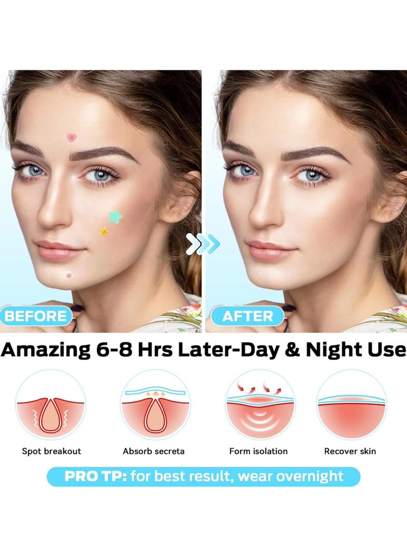 BTFMEI 200 Counts Acne Pimple Patch, Acne Covering Stickers for Face and Skin, Pimple Patch Daily Skin Care  - Image 3