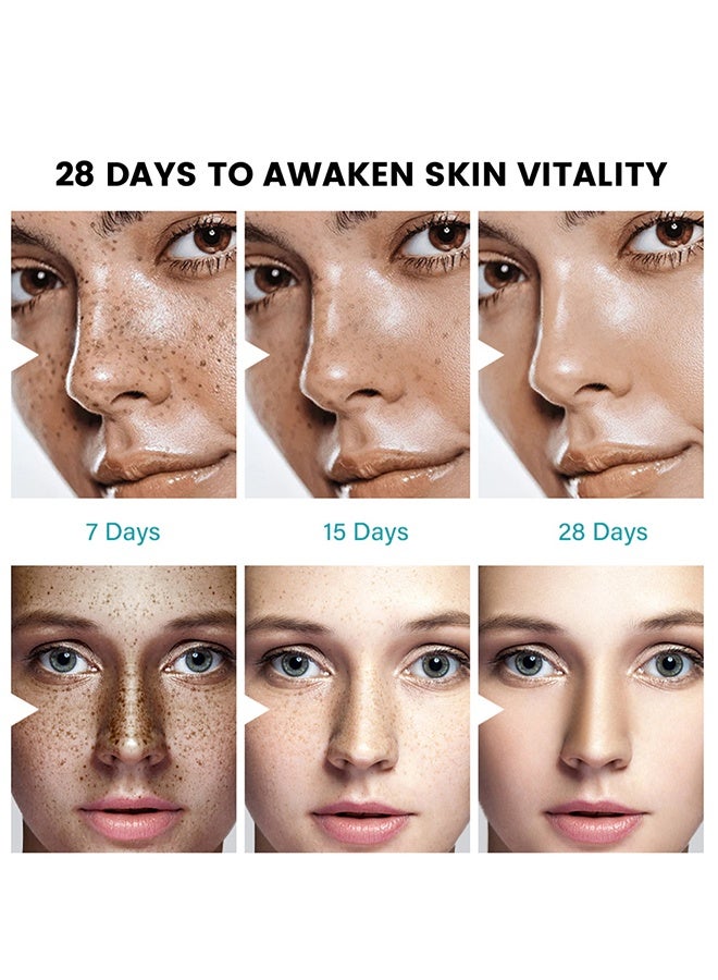 سوميفون كريم تخفيف الكلف - (تخفيف تبييض البقع الداكنة وتفتيح 100٪ مكونات طبيعية) فرط التصبغ ، الكلف ، النمش ، بقع الشمس - لجميع أنواع البشرة 20 جم - Image 5